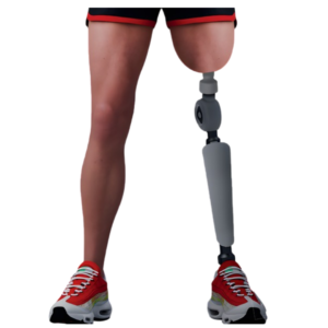 HASTE ENDO-EXO PARA OSTEOINTEGRAÇÃO